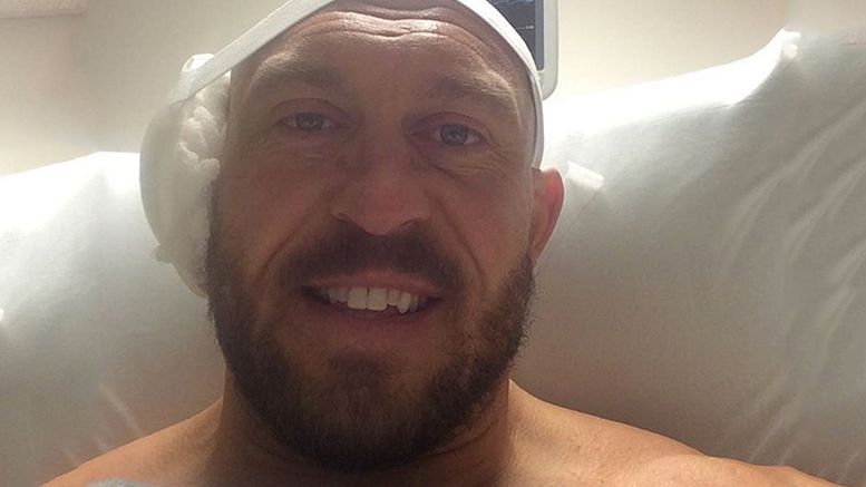 ryback ear sugery photo wwe wrestler contract