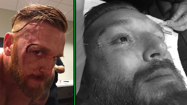 Heath Slater face cut open stitches live event wrestling wrestler wwe