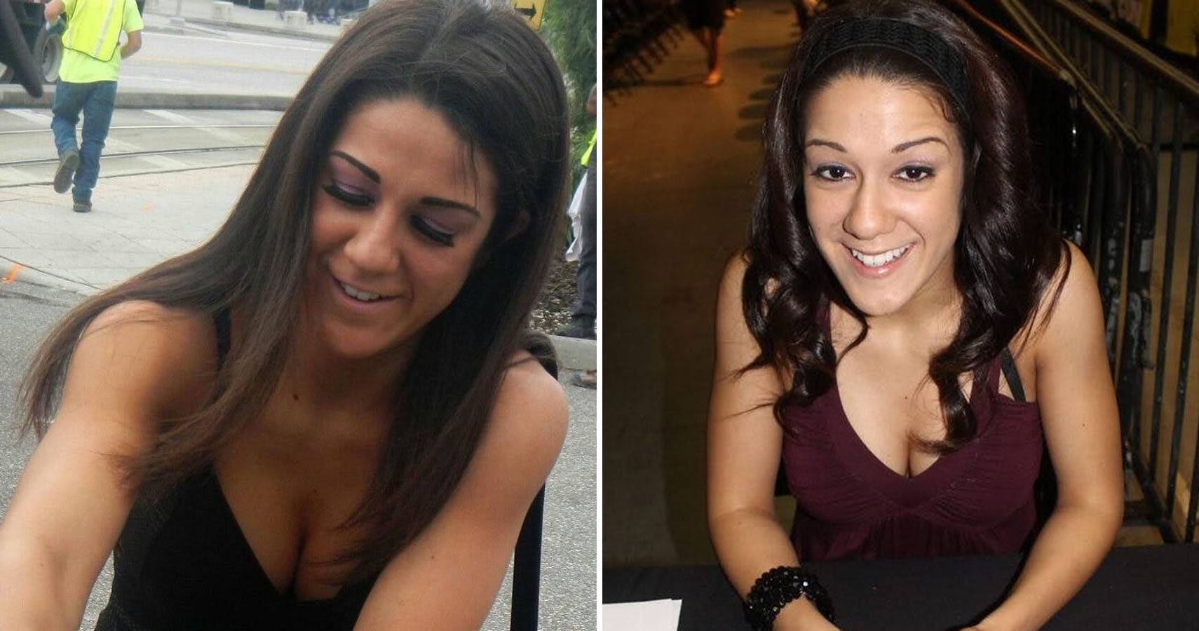 Bayley cleavage