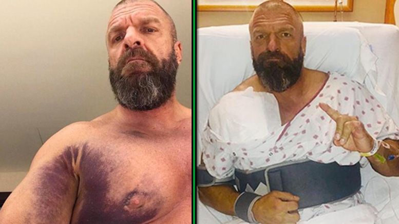 triple h takeover war games los angeles surgery injury