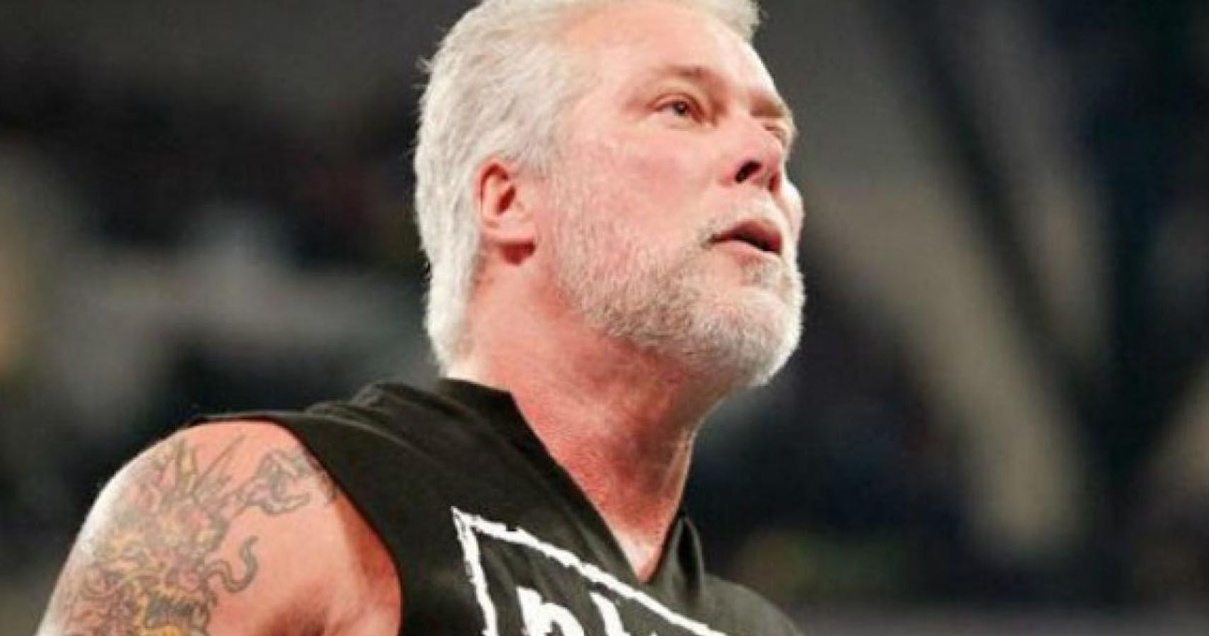 Kevin Nash Undergoes Heart Procedure