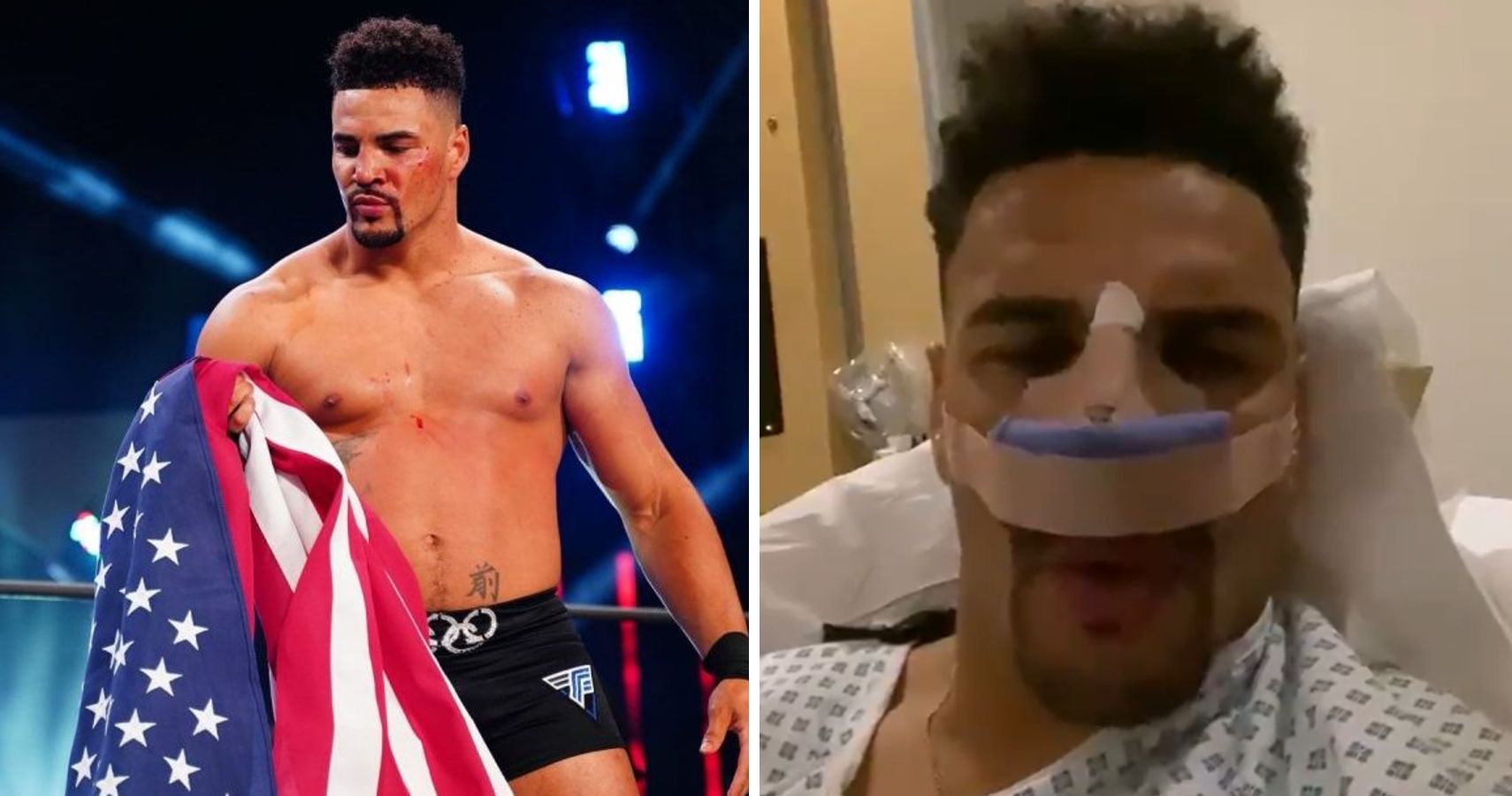 RIGHT: AEW star and former Olympic boxer Anthony Ogogo in AEW // LEFT: Anthony Ogogo after having surgery on his damaged eye