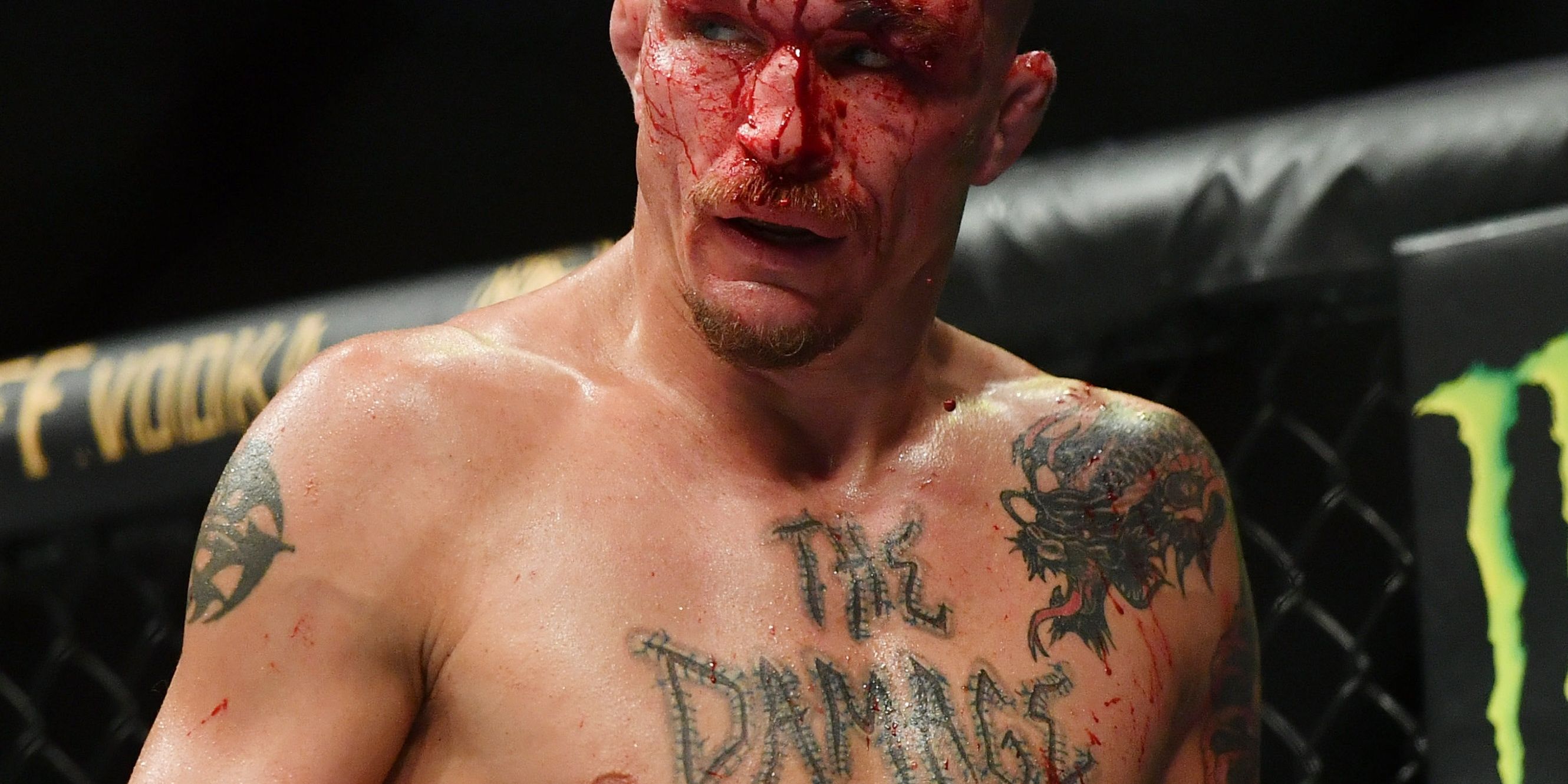 Darrin-Elkins-Bloodied-shows-off-his-The-Damage-tattoo