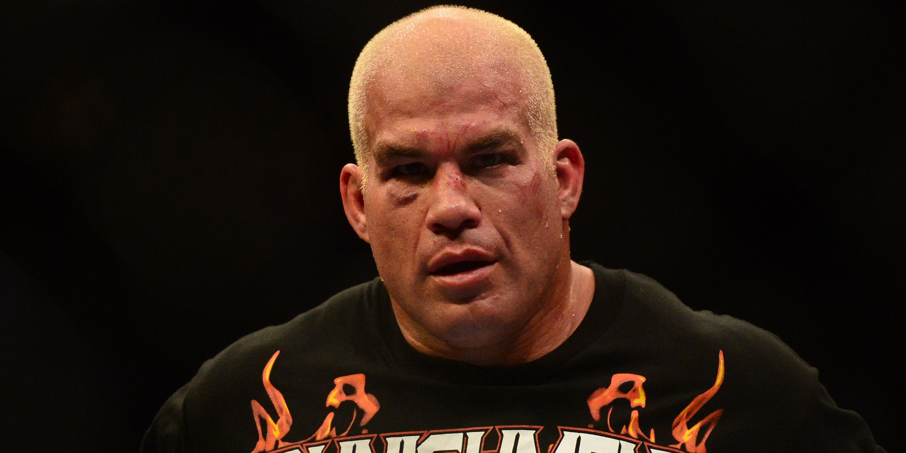 tito-ortiz-wearing-punishment-shirt-with-a-bruised-face