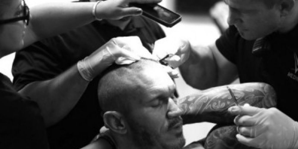 randy-orton-stitches