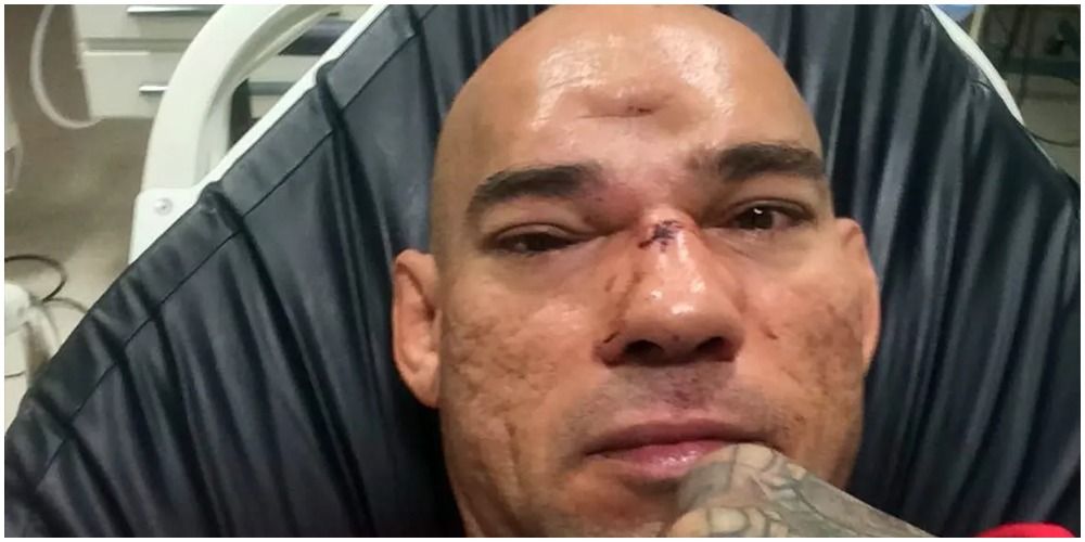 10 MMA Fighters Who Suffered Career-Ending Injuries in the Octagon