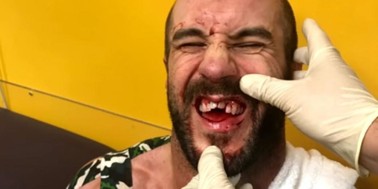 อาการบาดเจ็บที่ฟันของ Cesaro ถูกตัด