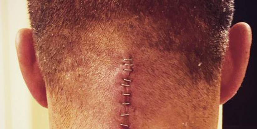 Tyson Kidd neck injury