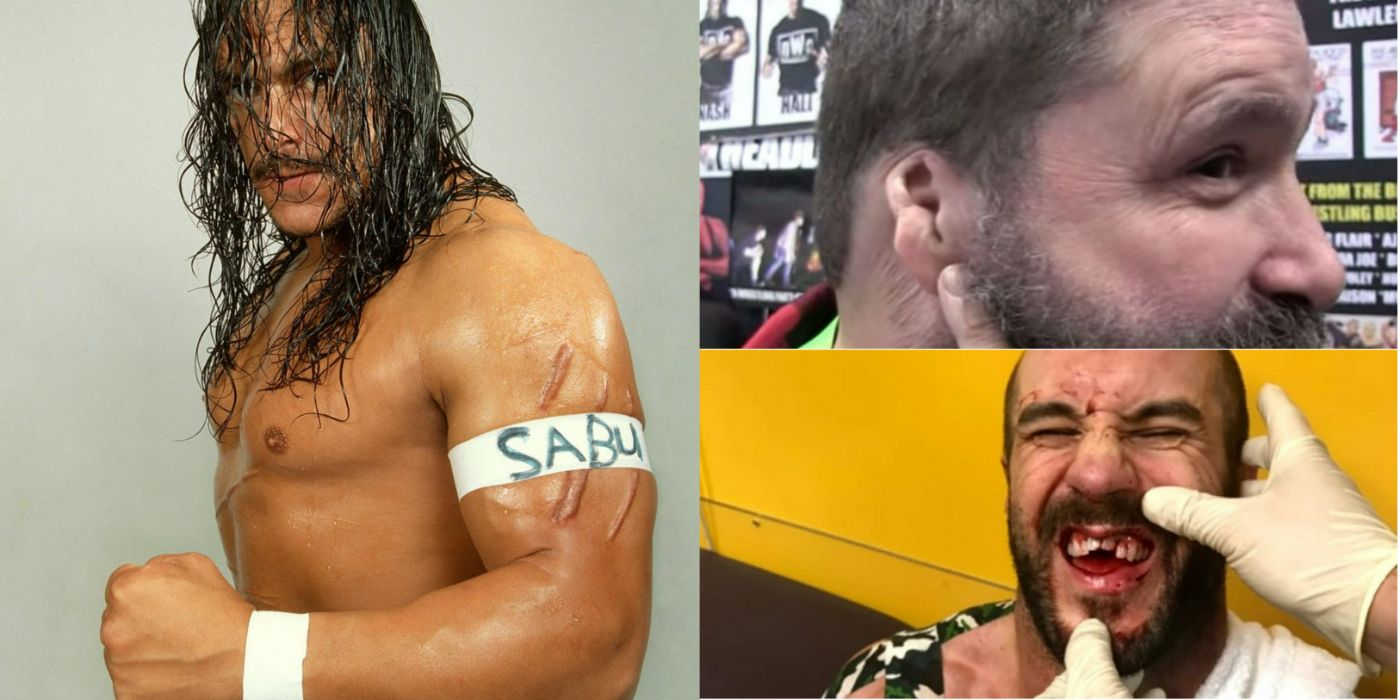 Wrestlers with scars from matches