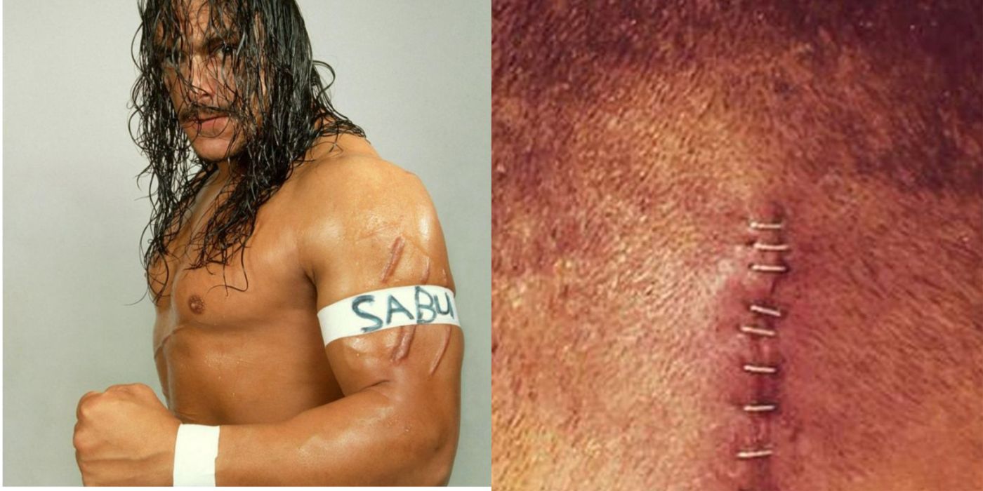 sabu scars