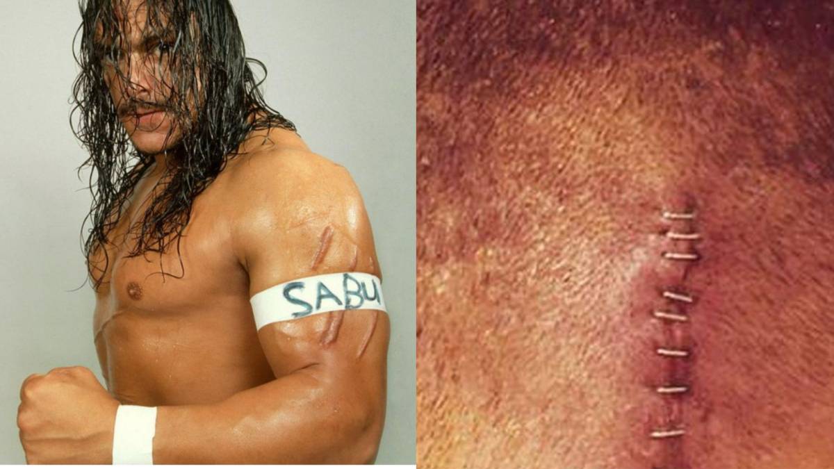 10 Wrestling Matches Which Physically Scarred A Wrestler For Life