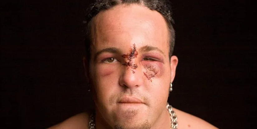 Joey Mercurys Face Cropped