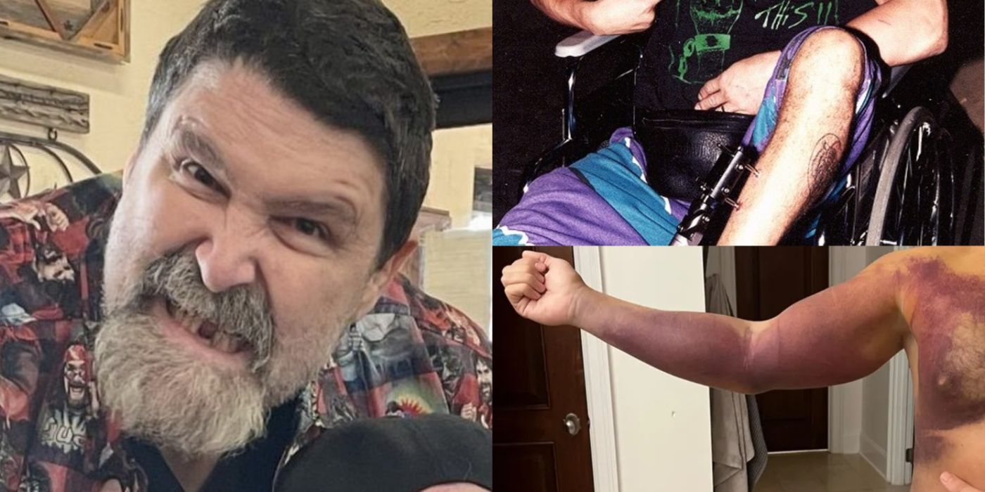 Mick Foley’s Ear & 9 More Visually Shocking Wrestling Injuries
