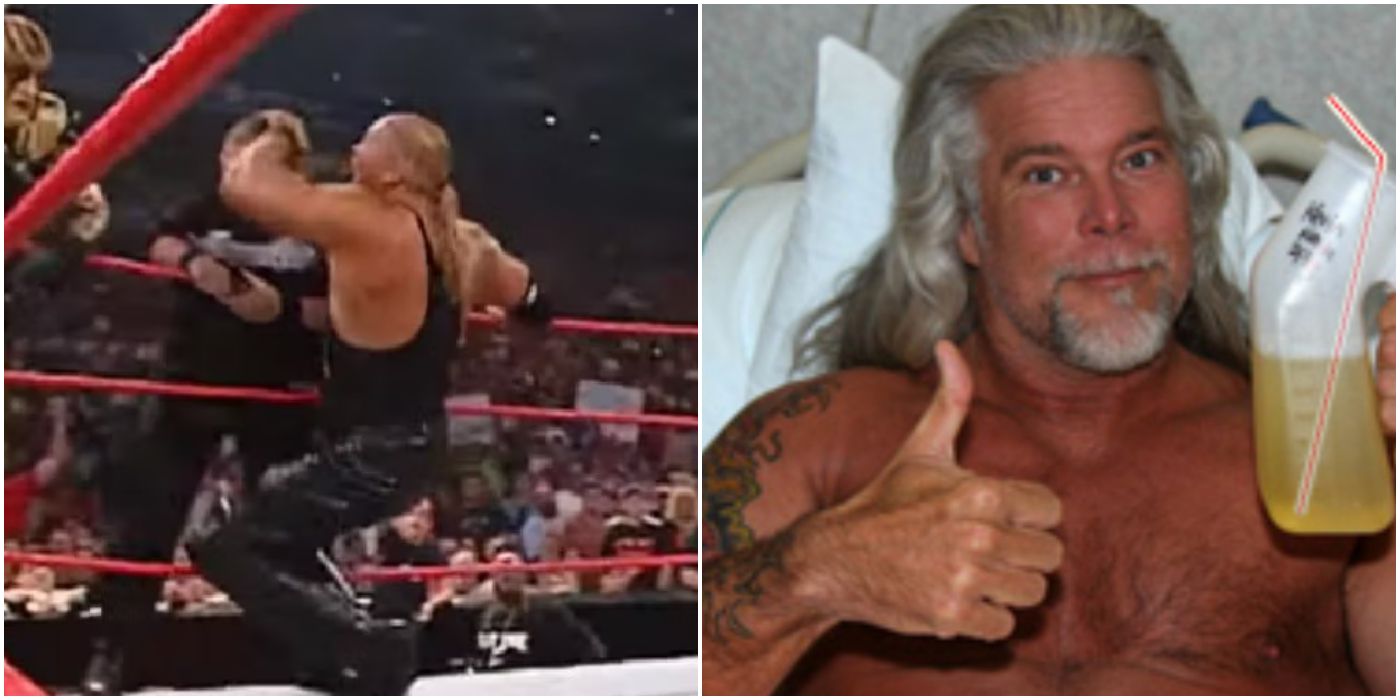 Pictures explaining Kevin Nash's injuries