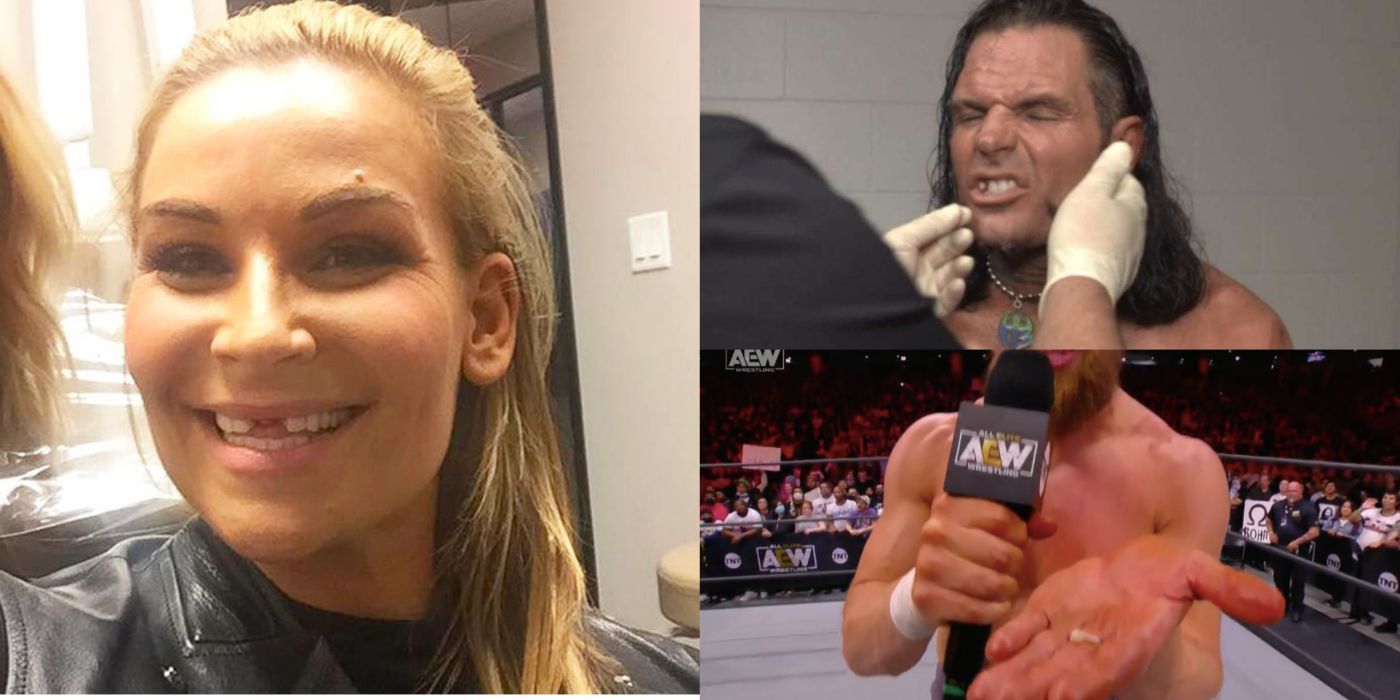 10 Pro Wrestlers Who Have Lost Their Teeth
