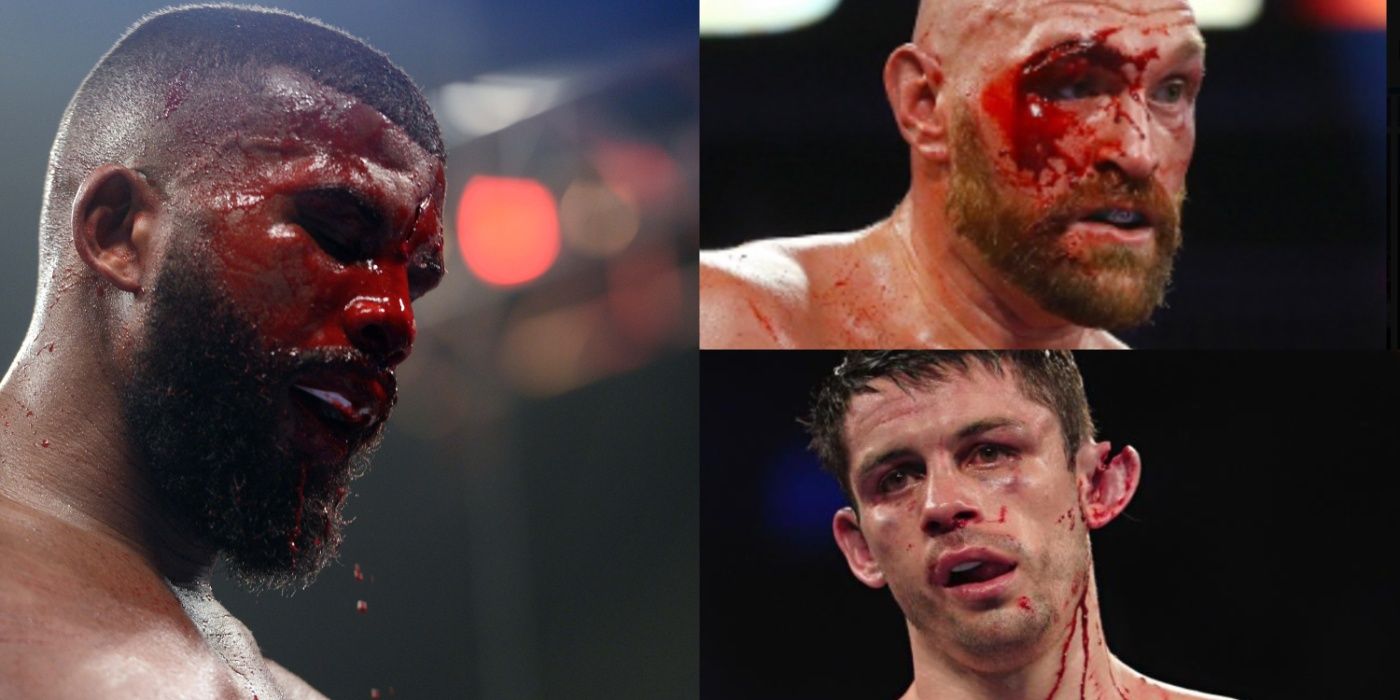 Worst injuries in boxing