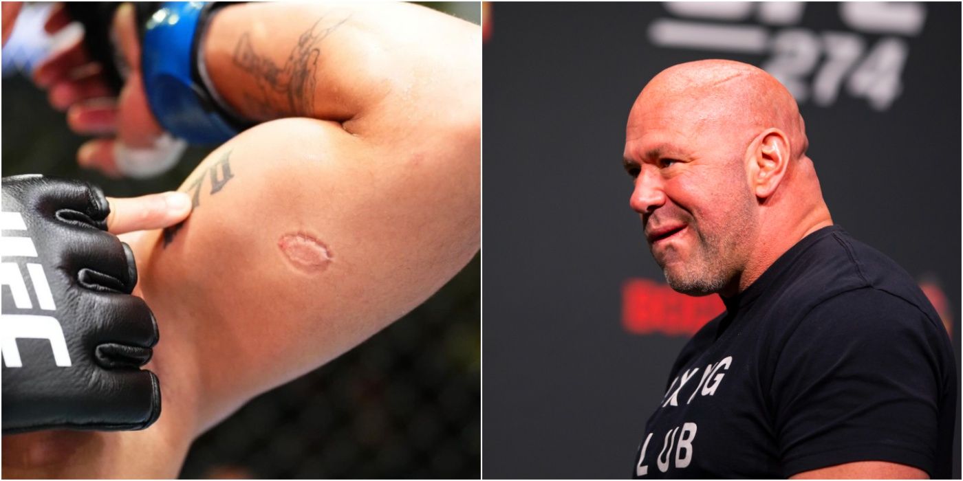 Dana White Confirms Igor Severino Is Cut For Biting Andre Lima During UFC Vegas 89