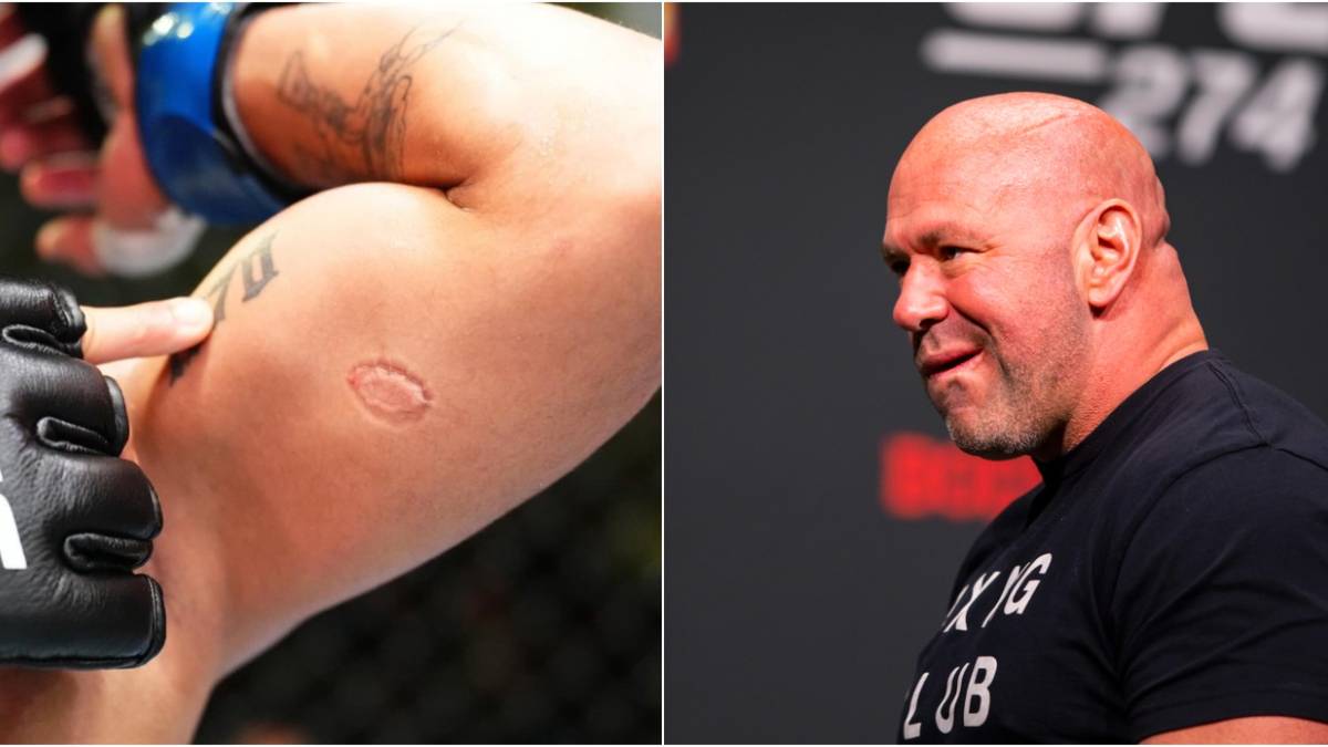 Dana White Confirms Igor Severino Is Cut For Biting Andre Lima During ...