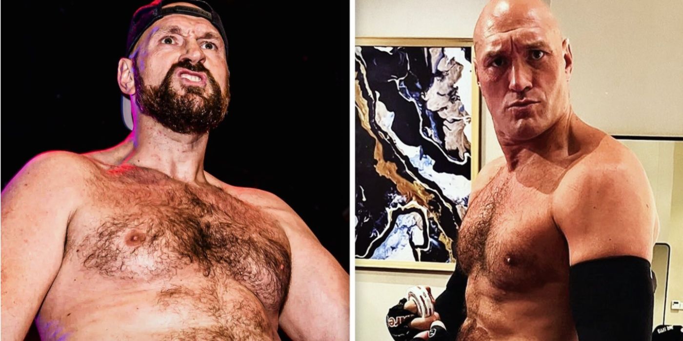 Tyson Fury before and after
