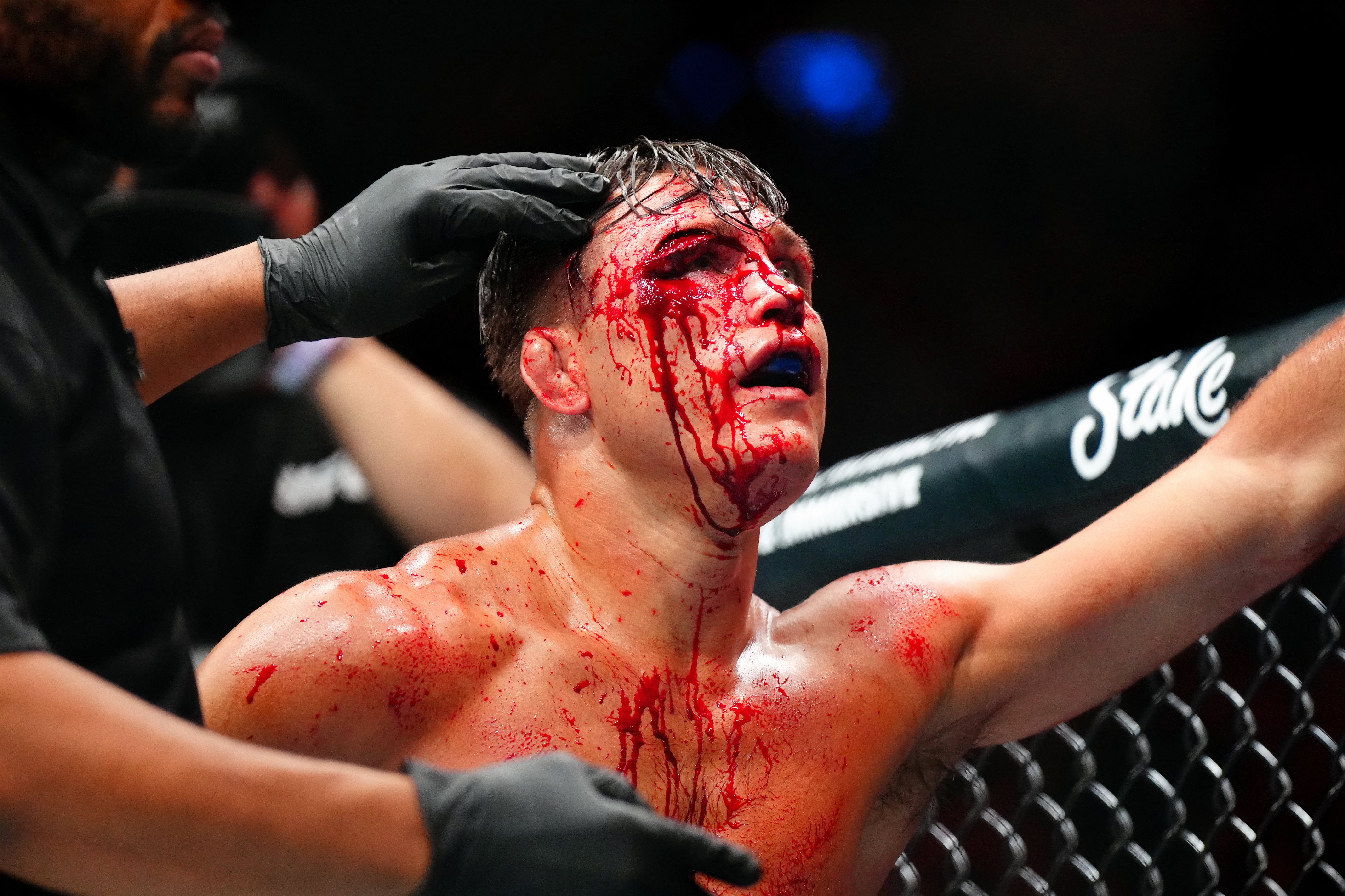 UFC Denver Results: Jean Silva wins after Drew Dober Horror Gruesome Cut Over eye